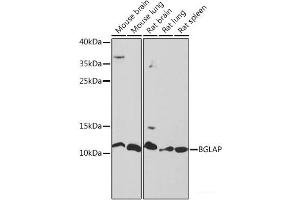 Western blot analysis of extracts of various cell lines using BGLAP Polyclonal Antibody at dilution of 1:1000. (Osteocalcin Antikörper)