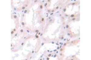 Used in DAB staining on fromalin fixed paraffin- embedded Kidney tissue (Spt6 Antikörper  (AA 532-666))