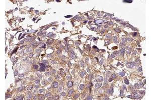 Immunohistochemistry (IHC) image for anti-Histone Deacetylase 5 (HDAC5) (pSer498) antibody (ABIN6255378)