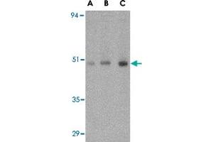 Western blot analysis of ORAI1 in human ovary tissue lysate with ORAI1 polyclonal antibody  at (A) 0. (ORAI1 Antikörper  (C-Term))