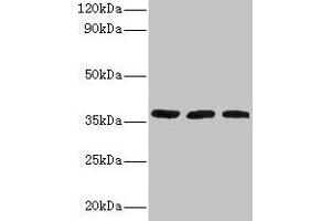 Western blot All lanes: FTSJ1 antibody at 2 μg/mL Lane 1: HepG2 whole cell lysate Lane 2: Mouse brain tissue Lane 3: EC109 whole cell lysate Secondary Goat polyclonal to rabbit IgG at 1/15000 dilution Predicted band size: 37, 36 kDa Observed band size: 37 kDa