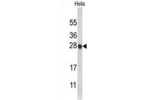 Western Blotting (WB) image for anti-Histone Cluster 1, H1c (HIST1H1C) antibody (ABIN3004061) (HIST1H1C Antikörper)