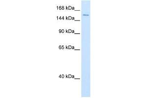 WB Suggested Anti-DHX9 Antibody Titration:  0. (DHX9 Antikörper  (N-Term))
