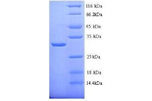 Carbonic Anhydrase I (CA1) (AA 2-261), (full length) protein (His tag) (CA1 Protein (AA 2-261, full length) (His tag))