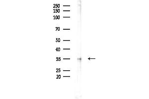 anti-Protein Phosphatase 1, Catalytic Subunit, gamma Isoform (PPP1CC) (N-Term) antibody