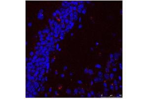 Immunohistochemistry (IHC) image for anti-Heat Shock 70kDa Protein 9 (Mortalin) (HSPA9) (C-Term) antibody (ABIN2779292)