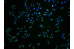 Immunofluorescence staining of Hela cells with ABIN7168054 at 1:100, counter-stained with DAPI. (GRK7 Antikörper  (AA 342-550))