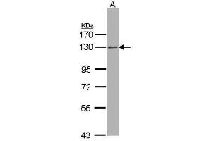WB Image Sample (30 ug of whole cell lysate) A: Hep G2 , 7. (ARHGEF18 Antikörper  (Center))