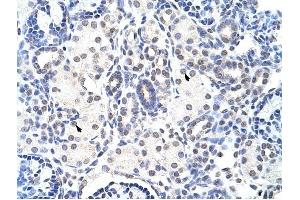 NIP7 antibody was used for immunohistochemistry at a concentration of 4-8 ug/ml to stain Epithelial cells of renal tubule (arrows) in Human Kidney. (NIP7 Antikörper)