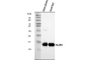 Western blot analysis of Hemoglobin/HBA1/HBA2 using anti-Hemoglobin/HBA1/HBA2 antibody (ABIN7602893).