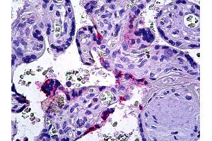 Anti-DOK3 antibody IHC of human placenta. (DOK3 Antikörper  (AA 484-496))