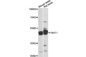 Western blot analysis of extracts of various cell lines, using TEKT1 antibody (ABIN6290784) at 1:1000 dilution. (TEKT1 Antikörper)