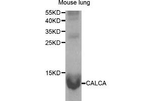 Western Blotting (WB) image for anti-Calcitonin-Related Polypeptide alpha (CALCA) antibody (ABIN1876765) (CGRP Antikörper)