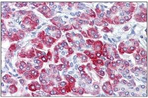 Human Pancreas: Formalin-Fixed, Paraffin-Embedded (FFPE) (RPS6 Antikörper  (C-Term))