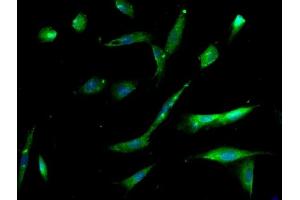 Image provided by One World Lab validation program. (Integrin Alpha3, Beta1 (AA 976-1025) Antikörper)