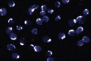 Immunofluorescent staining of Jurkat cells. (BCL2L1 Antikörper  (AA 18-233))