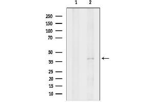 anti-Purinergic Receptor P2Y, G-Protein Coupled, 11 (P2RY11) antibody