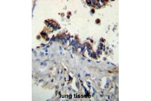 FCN3 Antibody (C-term) immunohistochemistry analysis in formalin fixed and paraffin embedded human lung tissue followed by peroxidase conjugation of the secondary antibody and DAB staining. (FCN3 Antikörper  (C-Term))