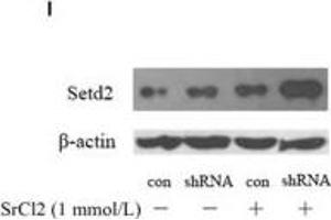 Western Blotting (WB) image for anti-SET Domain Containing 2 (SETD2) (AA 803-1103) antibody (ABIN1682666)