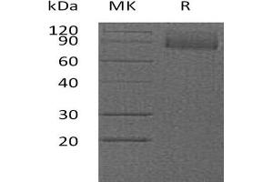 Western Blotting (WB) image for CD36 (CD36) protein (His tag,AVI tag) (ABIN7320864) (CD36 Protein (CD36) (His tag,AVI tag))