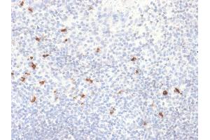 Formalin-fixed, paraffin-embedded human Tonsil stained with IgG4 Recombinant Rabbit Monoclonal Antibody (IGHG4/2042R). (Rekombinanter IGHG4 Antikörper)