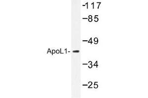 Image no. 1 for anti-Apolipoprotein L, 1 (APOL1) antibody (ABIN317817) (APOL1 Antikörper)