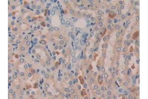 DAB staining on IHC-P; Samples: Mouse Kidney Tissue (MGEA5 Antikörper  (AA 83-222))