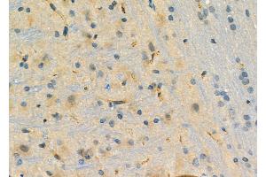 ABIN6261285 and ABIN6276758 at 1/100 staining Rat brain tissue by IHC-P. (Dihydrofolate Reductase Antikörper)