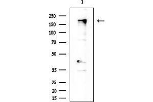 Western blot analysis of lysates from EC304 cells(heat-shock treatment), using BACH2 Antibody at 1/1000 dilution.