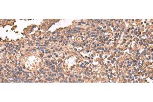 Immunohistochemistry of paraffin-embedded Human tonsil tissue using LDHAL6B Polyclonal Antibody at dilution of 1:65(x200) (LDHAL6B Antikörper)