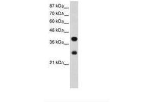 Image no. 2 for anti-Poly(rC) Binding Protein 2 (PCBP2) (AA 191-240) antibody (ABIN203085) (PCBP2 Antikörper  (AA 191-240))