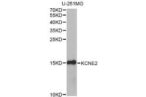 Western blot analysis of extracts of U-251MG cells, using KCNE2 antibody (ABIN6003591) at 1/1000 dilution. (KCNE2 Antikörper)
