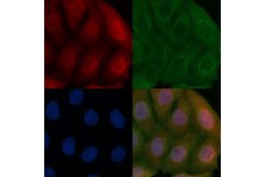 ALS2CR2 Mouse Monoclonal Antibody staining Hela cells by IF/ICC. (STRADB Antikörper)