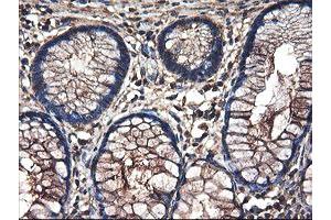 Immunohistochemical staining of paraffin-embedded Human colon tissue using anti-TUBAL3 mouse monoclonal antibody. (TUBAL3 Antikörper  (AA 150-446))