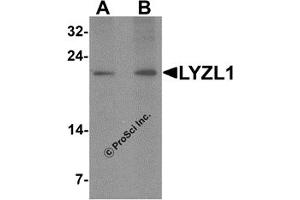 Western Blotting (WB) image for anti-Lysozyme-Like 1 (LYZL1) (N-Term) antibody (ABIN1587946)
