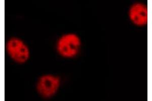 ABIN6267528 staining 293 by IF/ICC. (SAPK, JNK (pThr183) Antikörper)