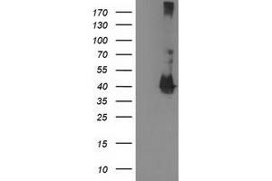 Western Blotting (WB) image for anti-Microtubule-Associated Protein, RP/EB Family, Member 2 (MAPRE2) antibody (ABIN1499317) (MAPRE2 Antikörper)