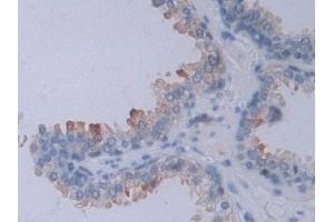 Detection of NRP2 in Human Prostate Tissue using Polyclonal Antibody to Neuropilin 2 (NRP2) (NRP2 Antikörper  (AA 231-490))