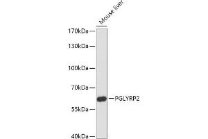 Western blot analysis of extracts of Mouse liver, using PGLYRP2 antibody (ABIN7269206) at 1:1000 dilution. (PGLYRP2 Antikörper)