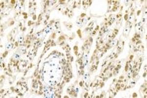 Immunohistochemistry analysis of paraffin-embedded rat placenta using,PNN (ABIN7075083) at dilution of 1: 1200 (PNN Antikörper)