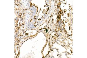 Immunohistochemistry of paraffin-embedded mouse lung using Annexin  Rabbit pAb  at dilution of 1:25 (40x lens). (Annexin A2 Antikörper)
