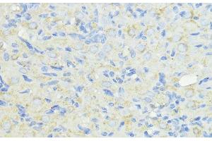 Immunohistochemistry of paraffin-embedded Rat ovary using CTSB Polyclonal Antibody at dilution of 1:100 (40x lens). (Cathepsin B Antikörper)