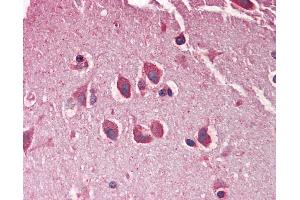 Anti-MXRA5 antibody IHC staining of human brain, cortex. (Adlican Antikörper  (AA 1454-1467))