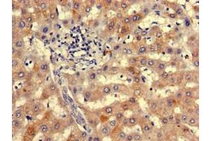 Immunohistochemistry of paraffin-embedded human liver tissue using ABIN7161618 at dilution of 1:100 (NIPBL Antikörper  (AA 2523-2697))