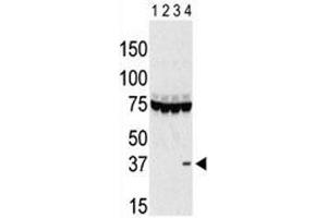 Western blot testing of Aurora-C antibody and lysate of 293 cells expressing 1) Flag tag, 2) Flag-tagged -A, 3) -B and 4) Aurora-C. (Aurora Kinase C Antikörper  (AA 115-145))