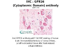 Image no. 1 for anti-G Protein-Coupled Receptor 26 (GPR26) (3rd Cytoplasmic Domain) antibody (ABIN1735037)