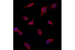 ABIN6266223 and ABIN6277374 staining HepG2 by IF/ICC. (Gelsolin Antikörper  (C-Term))