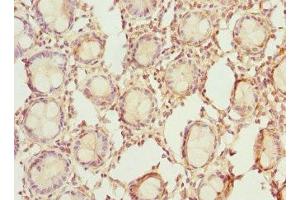 Immunohistochemistry of paraffin-embedded human colon tissue using ABIN7142076 at dilution of 1:100
