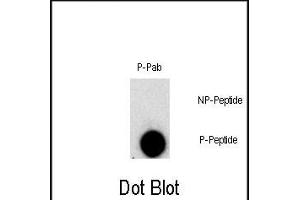 Dot blot analysis of Phospho-FGFR1- polyclonal antibody `a on nitrocellulose membrane. (FGFR1 Antikörper  (pTyr307))