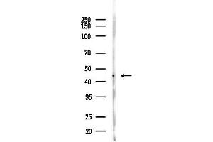anti-Muscleblind-like Protein 1 (MBNL1) (C-Term) antibody